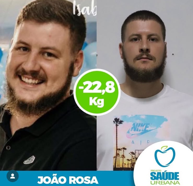 João Rosa — antes e depois, −22,8 kg no protocolo